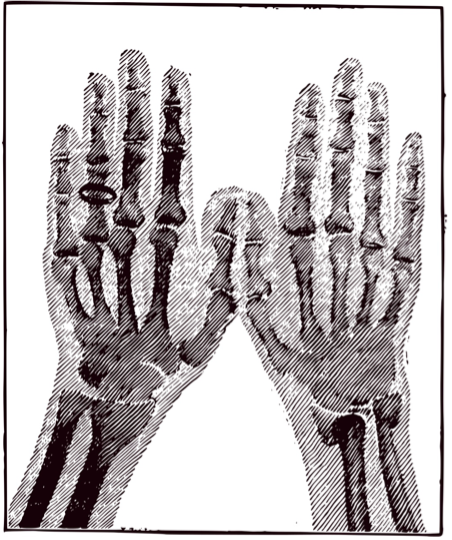 手の骨のイメージ